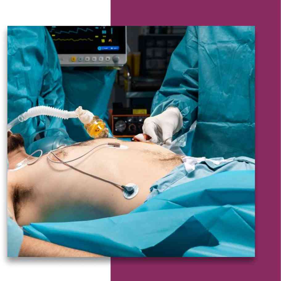 Esophagus Management