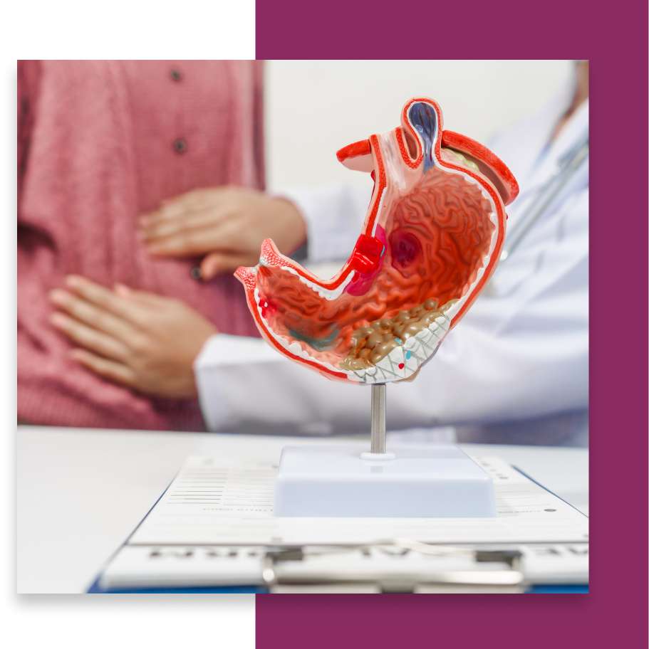 Types of Esophagus Cancer