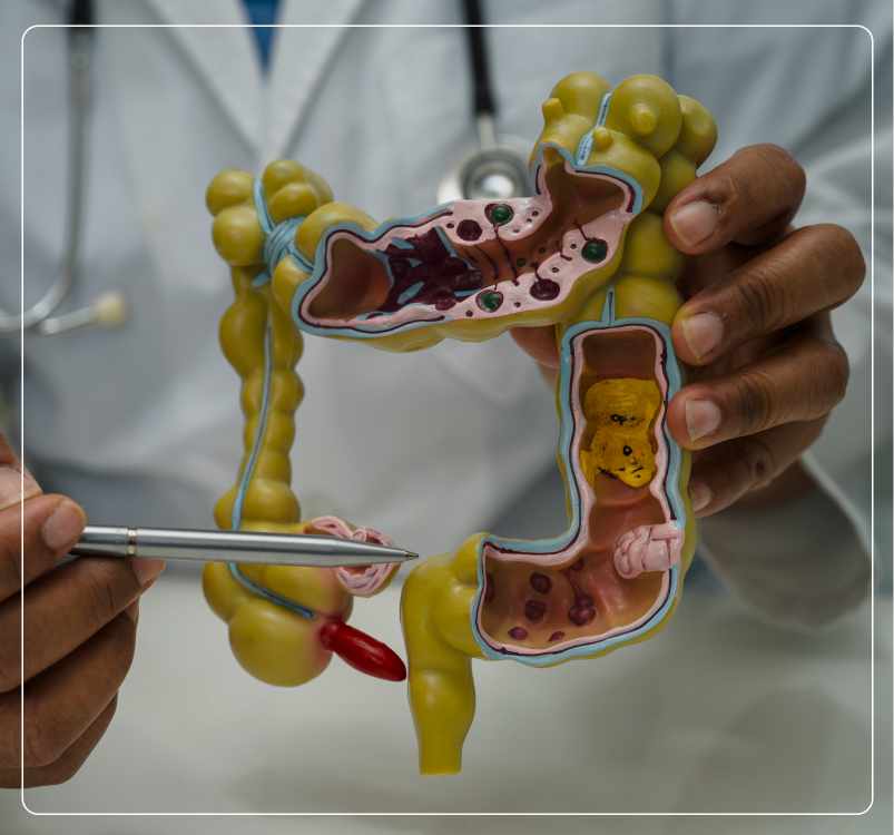 Types of Gastrointestinal Cancer