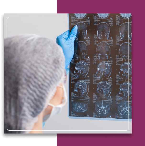 Malignant Brain Tumors Malignant Brain Tumors