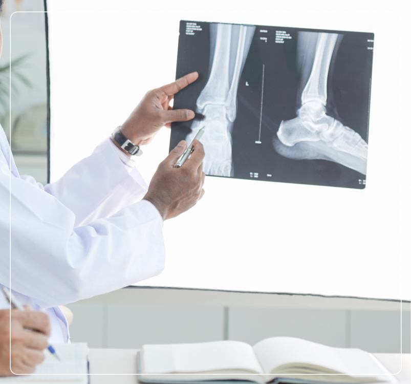 Bone Cancer<br />
Management