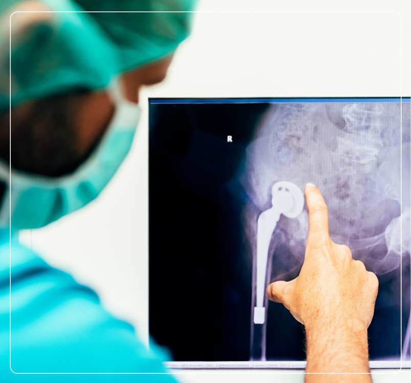 Bone Cancer Management