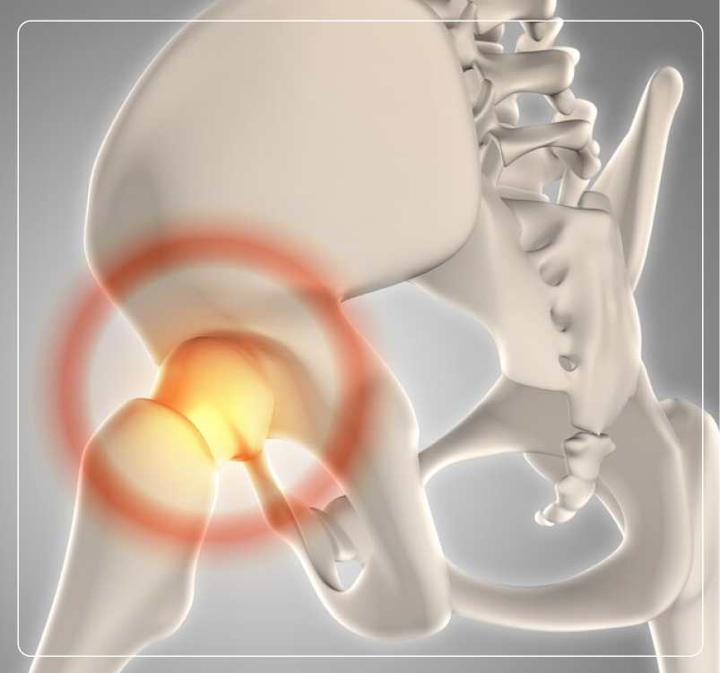 Types of Bone & Soft Tissue Cancer