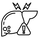 Liver cirrhosis