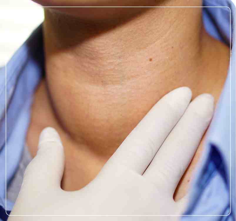 Symptoms of Thyroid Cancer
