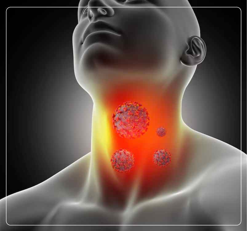 Thyroid Cancer Preventions