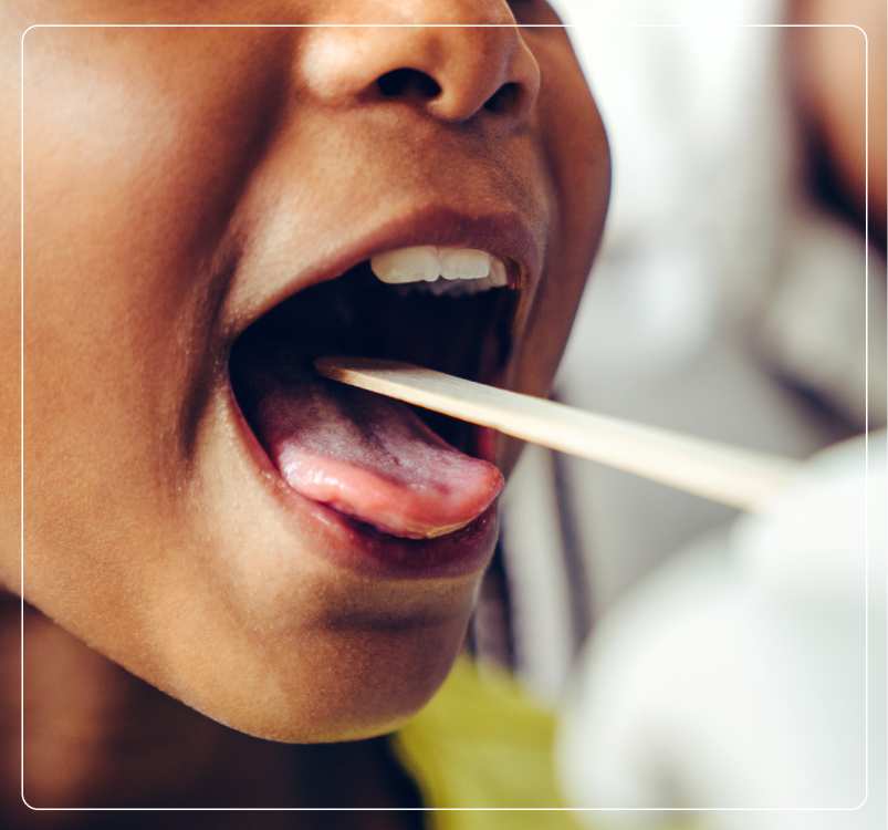 Tongue Cancer Symptoms