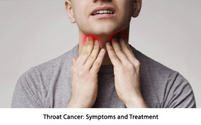 Throat Cancer: Symptoms and Treatment
