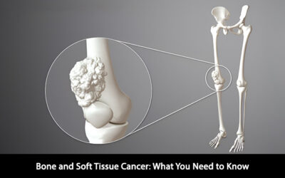 Bone and Soft Tissue Cancer: What You Need to Know