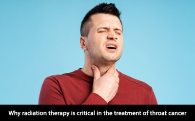 Why radiation therapy is critical in the treatment of throat cancer